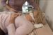 Respiratory Complications and Management